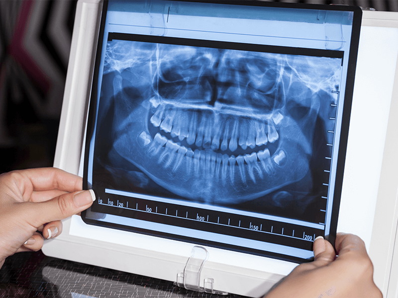 los-cinco-tipos-de-radiografias-dentales-mas-frecuentes