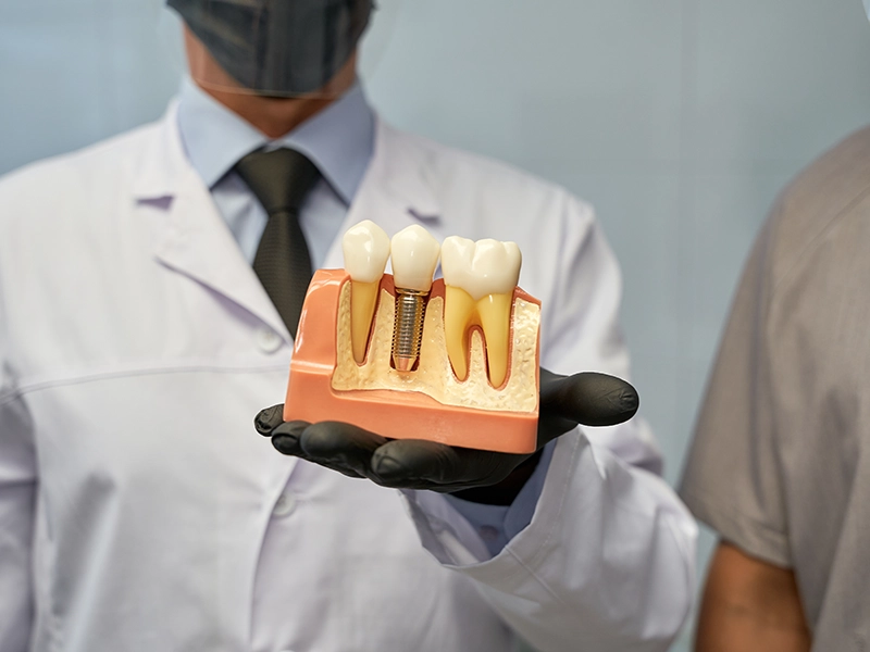 que-son-los-implantes-dentales-procedimiento-quirurgico-previa-dental-works-tijuana
