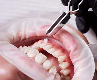 son-las-encargadas-de-proporcionar-una-vista-detallada-de-la-estructura-dental-las-raices-y-el-tejido-circundante-previa-mx
