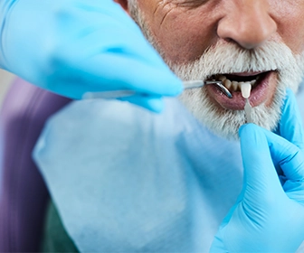 los-implantes-dentales-son-una-opcion-popular-para-las-personas-que-han-perdido-dientes-debido-a-la-enfermedad-de-las-encias-previa-mx